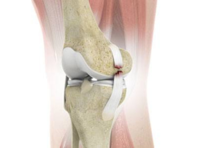MCL Injury Treatment in Ahmedabad / Gujarat